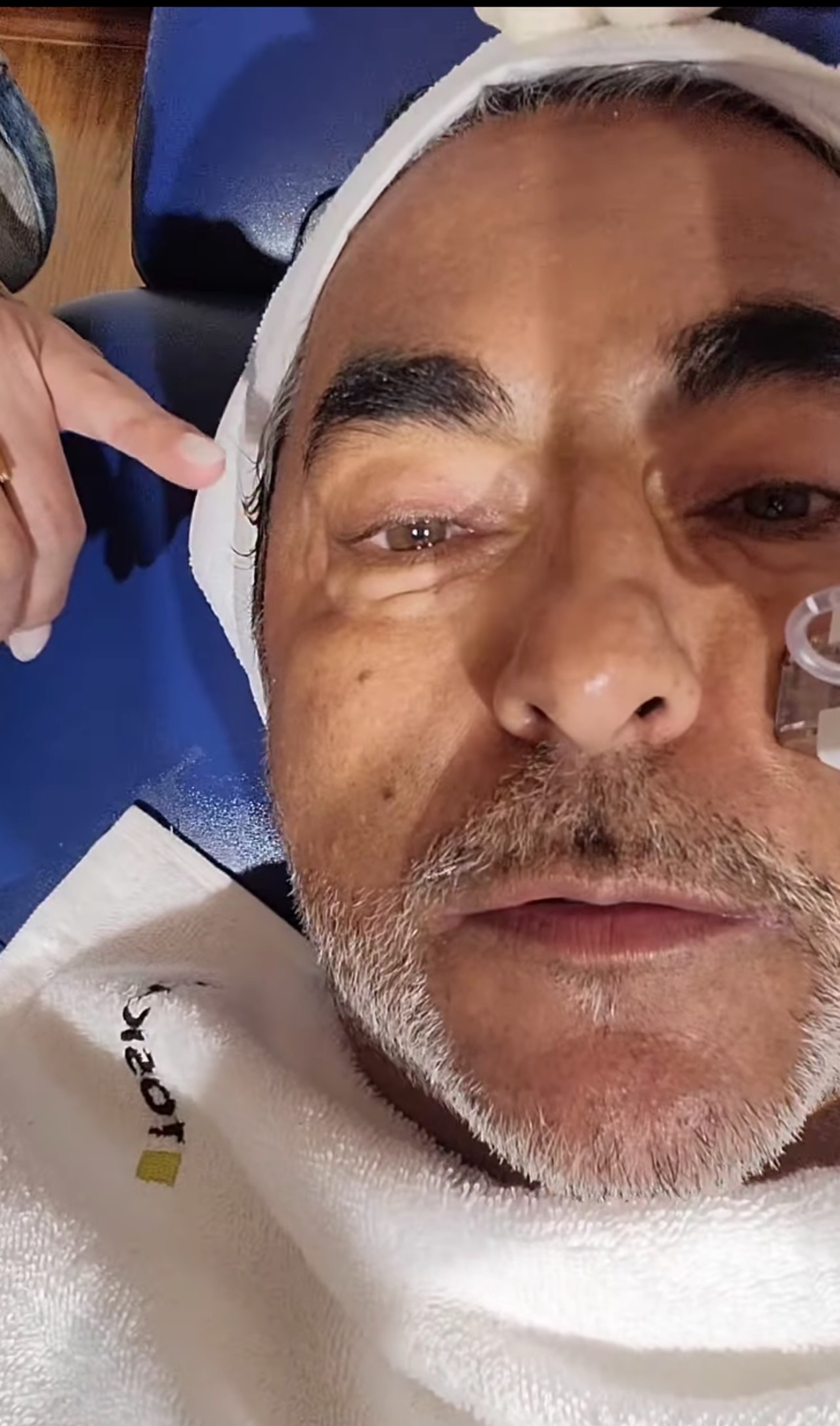 Raúl Araiza cara arreglitos esteticos tratamiento