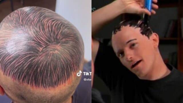 hombre calvicie pelo