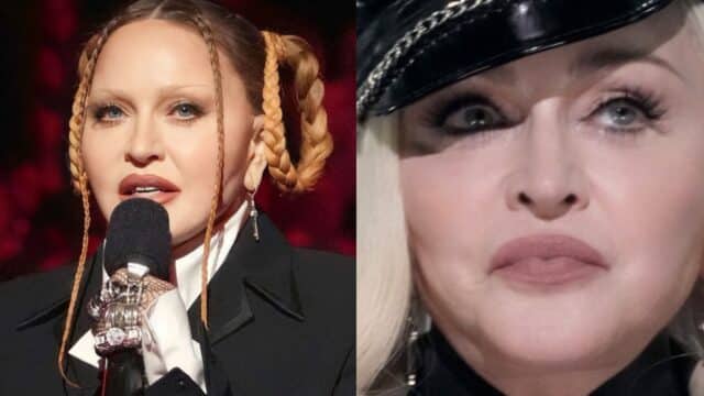 Madonna presume rostro tras la cirugia