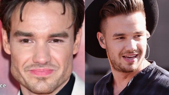 Lyam Payne One Direction bichectomia