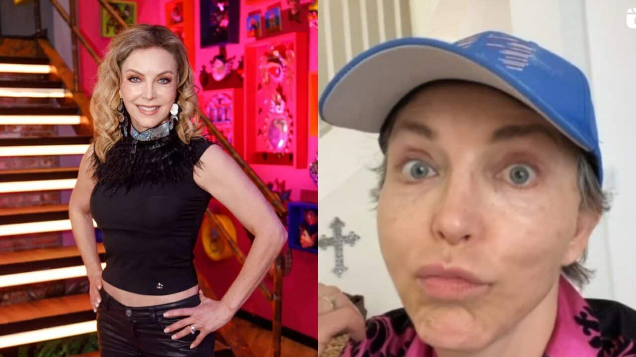 Laura Flores arreglitos duele ser fea