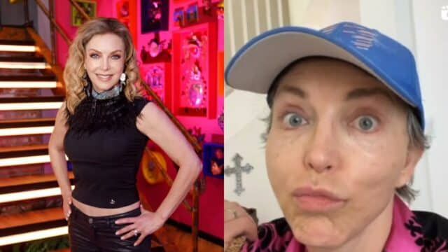 Laura Flores arreglitos duele ser fea