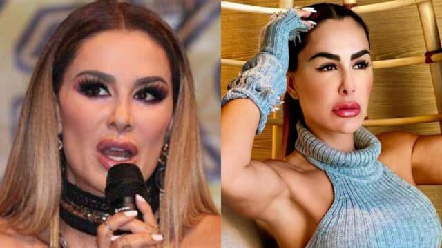 Ninel Conde cirugías