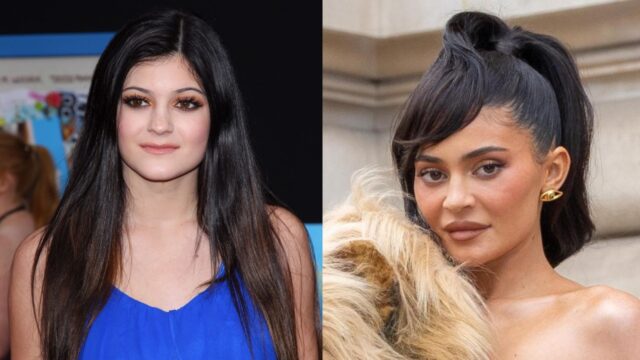 Kylie Jenner cirugías rostro