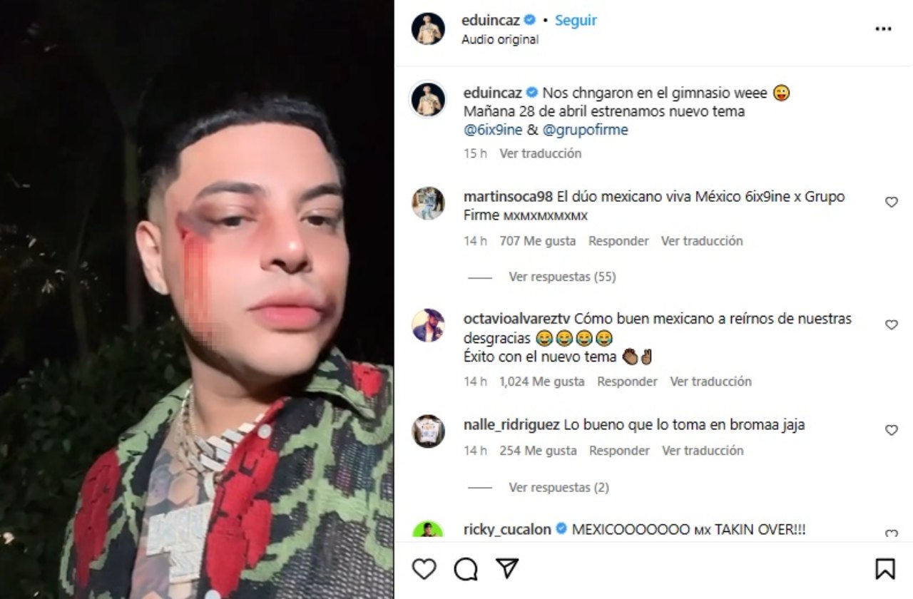 Eduin Caz ojo golpeado abierto rapero