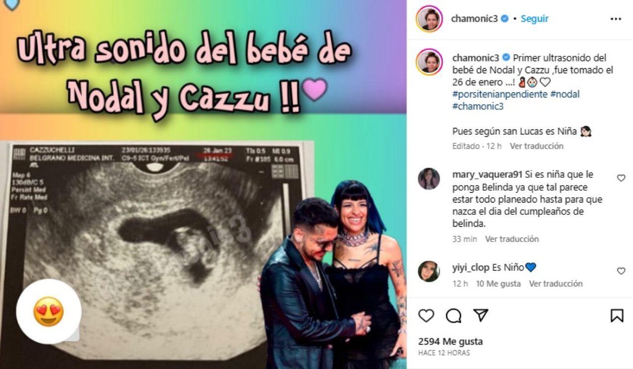 Primer ultrasonido Cazzu bebe niño niña