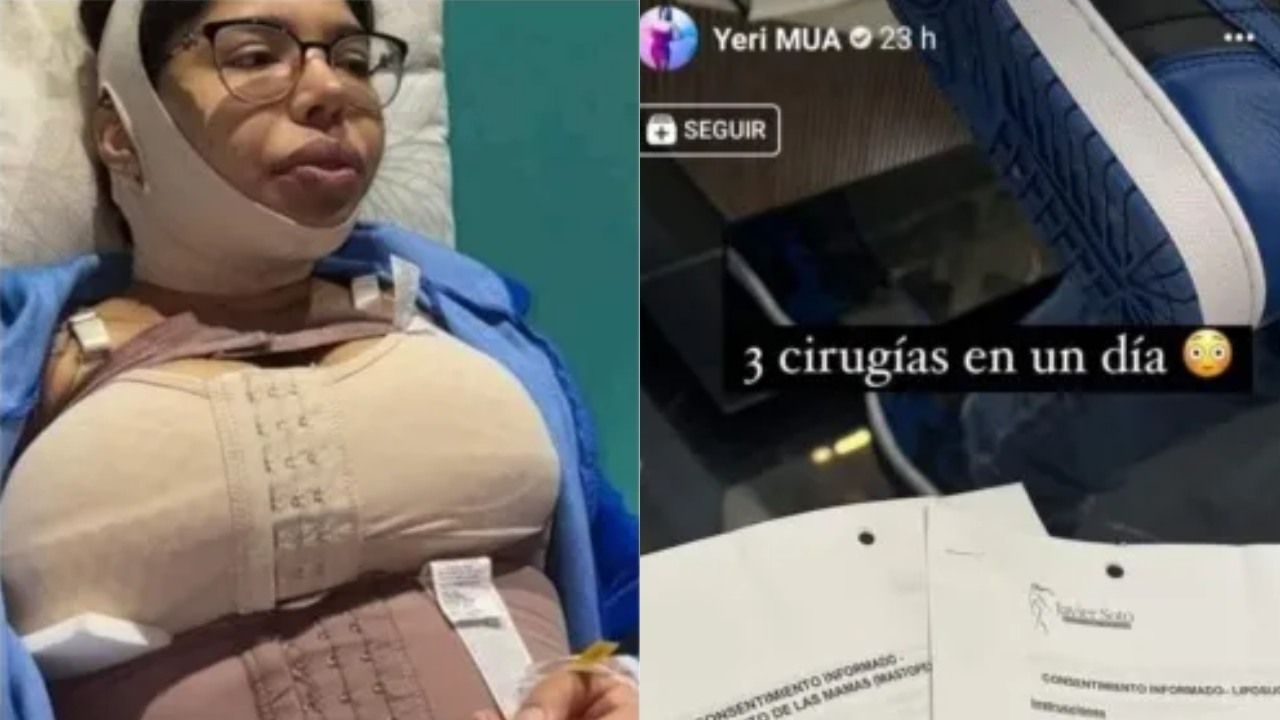 Yeri Mua antes y despues cirugias