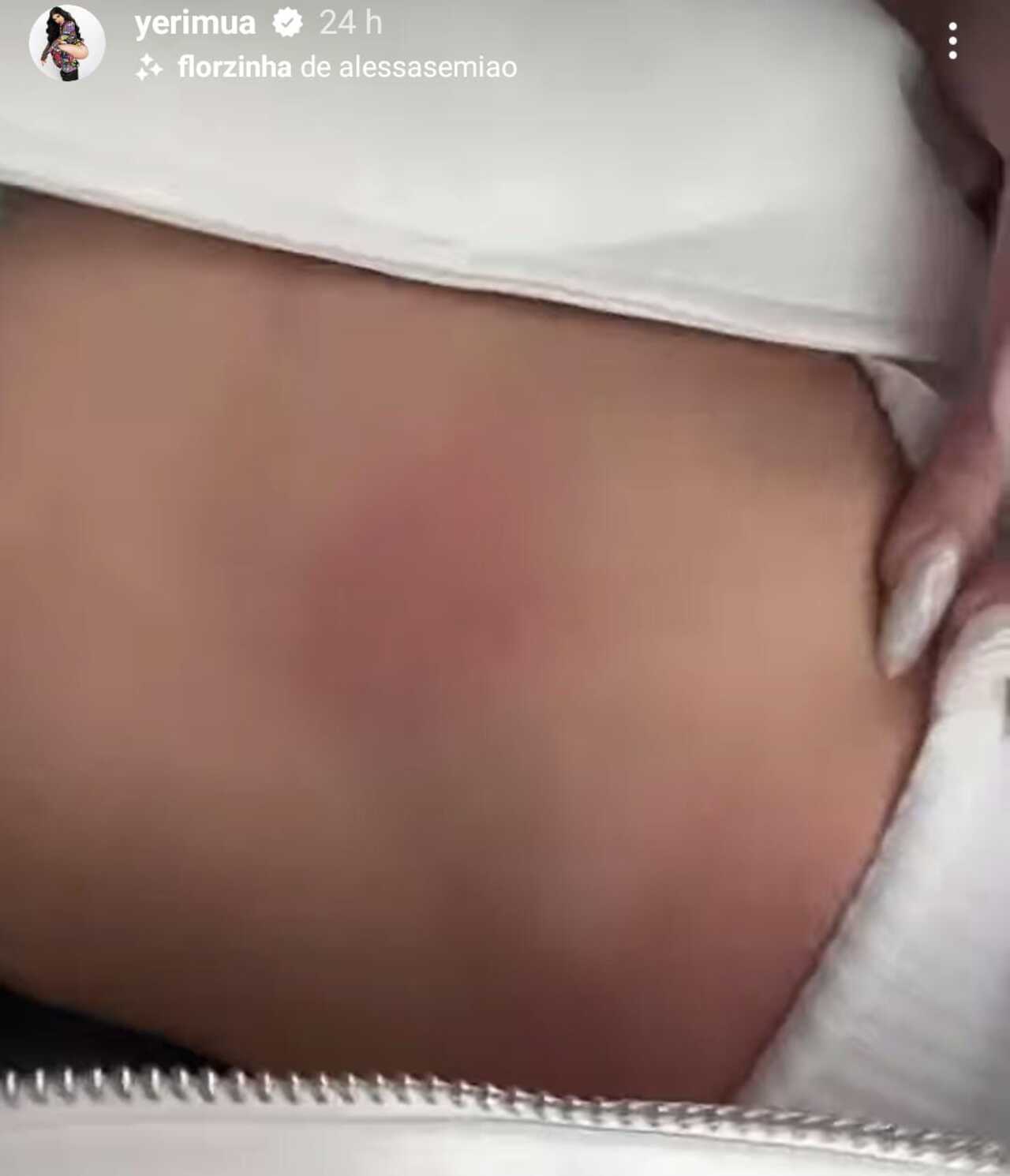 Yeri Mua golpes cuerpo