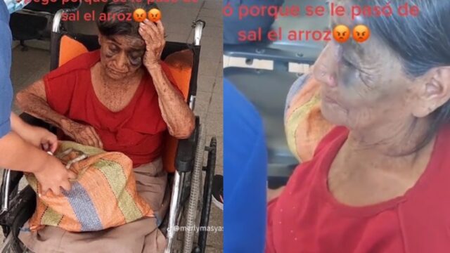 Abuelita golpeada esposo pasarse sal comida accidente