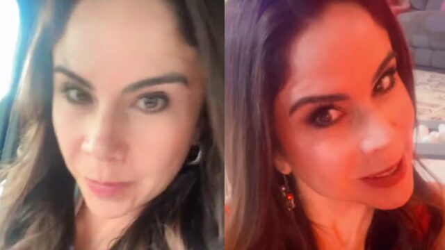 Paola Rojas llena de bótox destacada