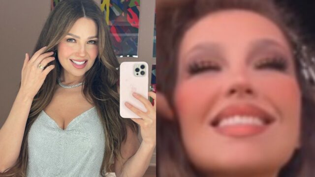 Destrozan Thalia deformar rostro criticas botox