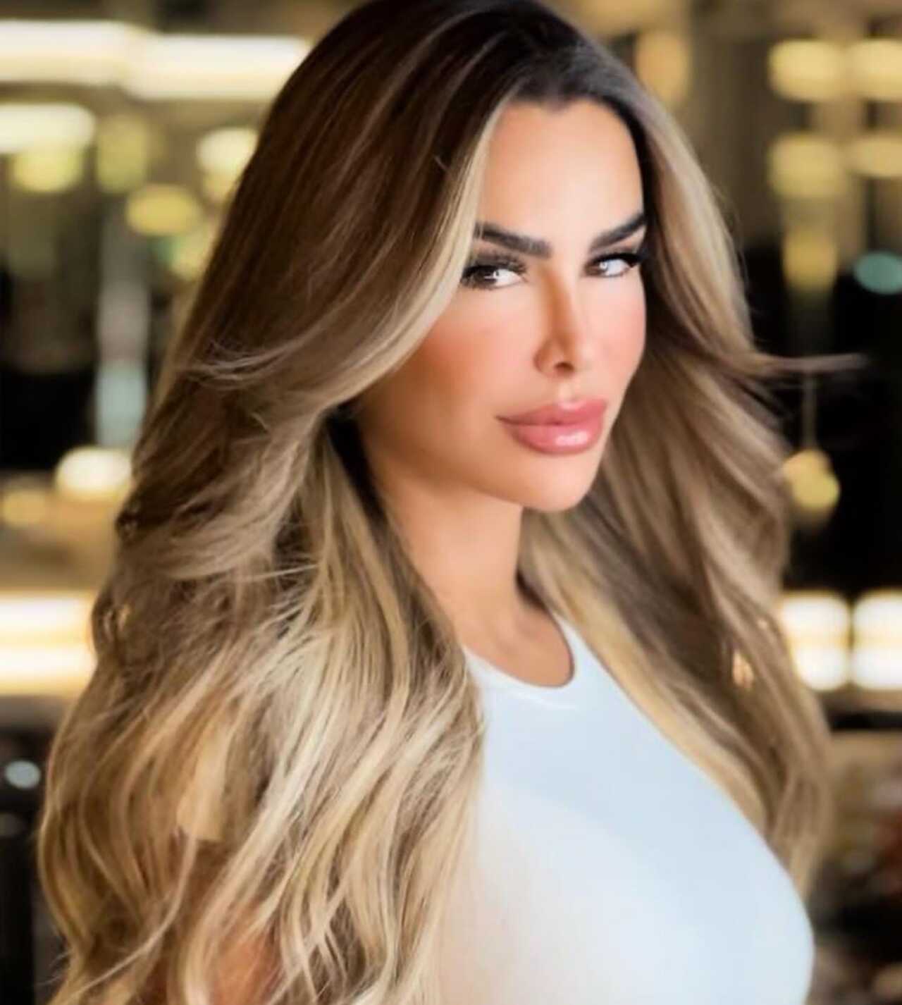 Ninel conde defiende el botox