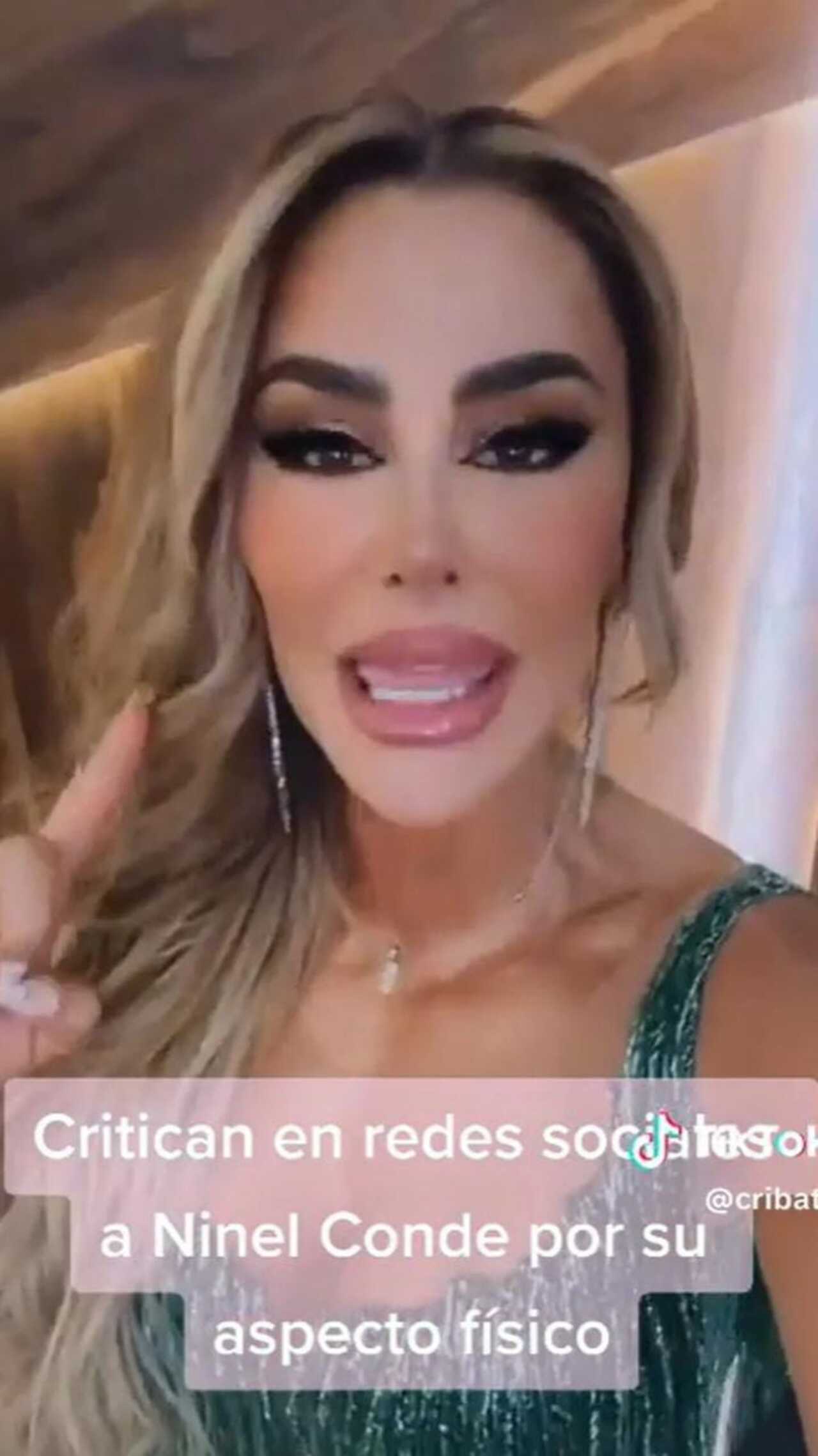 Ninel conde rostro desfigurado