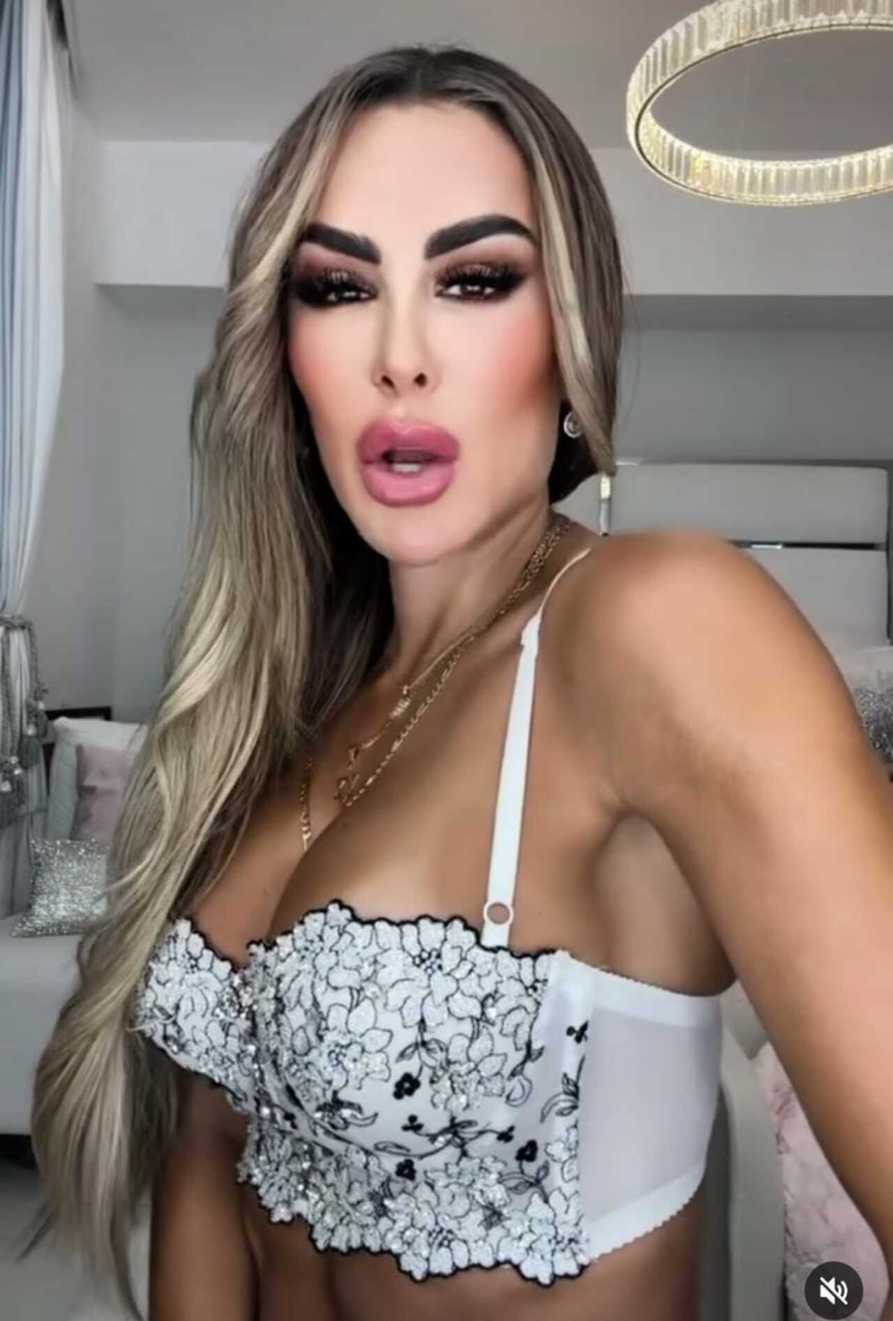 Ninel conde cirugías cara