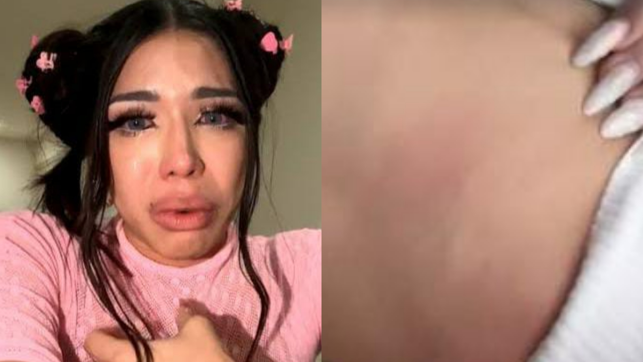 Yeri Mua aparece con moretones