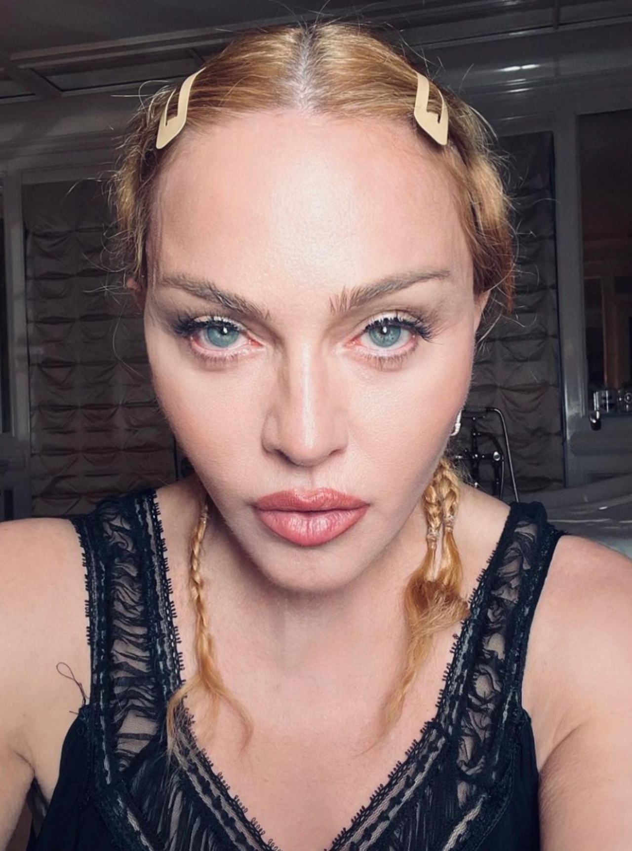 Madonna hospitalizada posponen gira