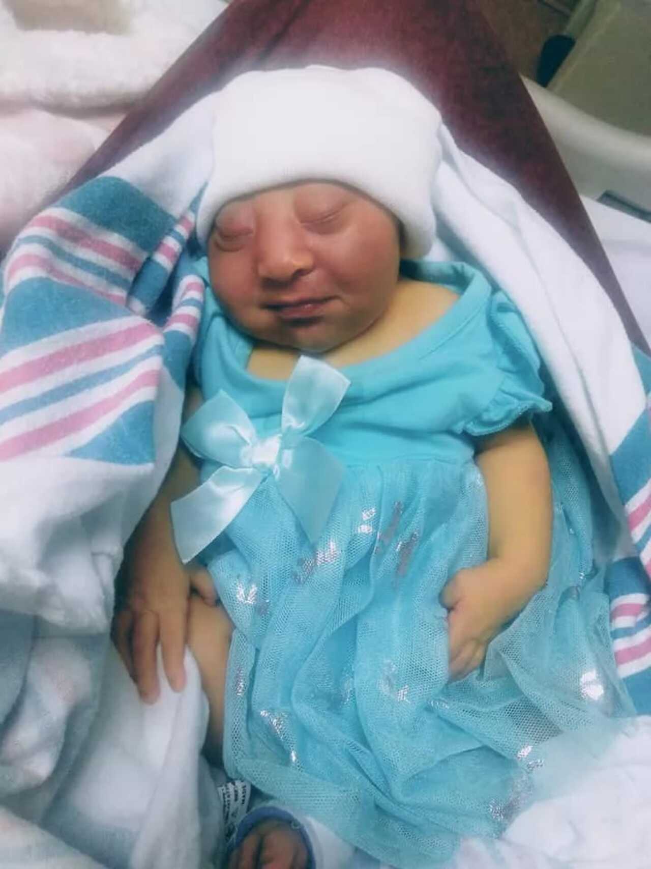 Fallece bebé de una mujer tras nacer con anomalías y padres deciden donar sus órganos