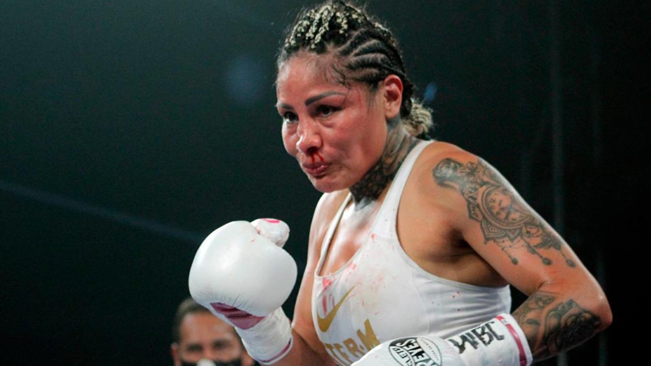Barby Juárez secuelas box